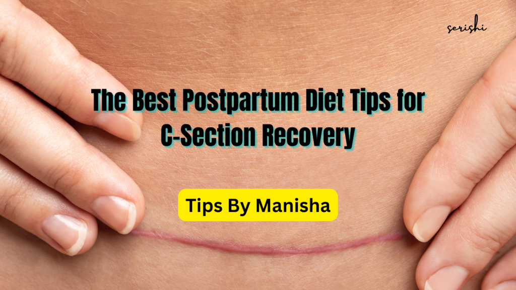 The Best Postpartum Diet Tips for C-Section Recovery